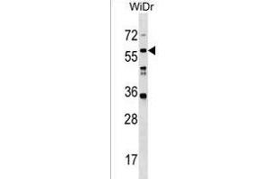 LRRC14B Antibody (N-term) (ABIN1539457 and ABIN2850224) western blot analysis in WiDr cell line lysates (35 μg/lane). (LRRC14B 抗体  (N-Term))