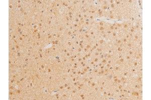 ABIN6267272 at 1/100 staining mouse brain tissue sections by IHC-P. (c-MYC 抗体  (pThr58))