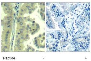 Image no. 3 for anti-Eukaryotic Translation Initiation Factor 4 Gamma, 1 (EIF4G1) (Ser1232) antibody (ABIN319387) (EIF4G1 抗体  (Ser1232))