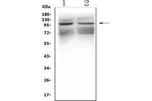 Western blot analysis of GRIK1 using anti-GRIK1 antibody (ABIN3042430).