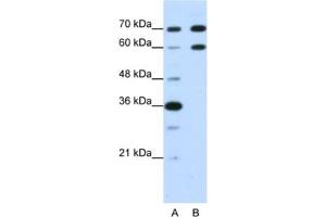 Western Blotting (WB) image for anti-Doublesex and Mab-3 Related Transcription Factor 2 (DMRT2) antibody (ABIN2462015) (DMRT2 抗体)