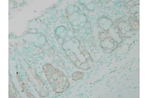 Immunohistochemistry analysis using Rabbit Anti-Ubiquitin Polyclonal Antibody . (Ubiquitin 抗体  (APC))