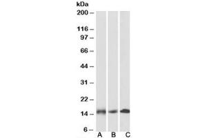 Western blot testing of human [A], mouse [B] and rat [C] heart lysates with NDUFA7 antibody at 0. (NDUFA7 抗体)
