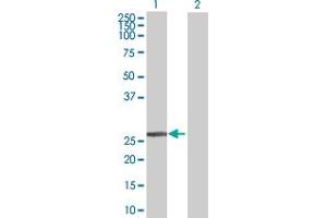 Western Blot analysis of DCXR expression in transfected 293T cell line by DCXR MaxPab polyclonal antibody. (DCXR 抗体  (AA 1-244))