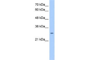NRG1 (neuregulin 1) Antibody (against the middle region of NRG1) (50ug) validated by WB using Jurkat cell lysate at 0. (Neuregulin 1 抗体  (Middle Region))