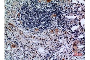 Immunohistochemistry (IHC) analysis of paraffin-embedded Human Lung, antibody was diluted at 1:100. (Transferrin Receptor 抗体  (N-Term))