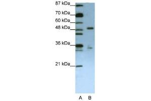 UPF3B antibody used at 1. (UPF3B 抗体)
