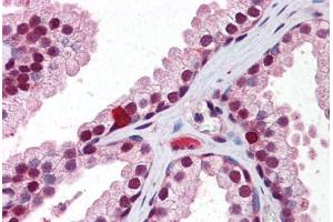 Human Prostate: Formalin-Fixed, Paraffin-Embedded (FFPE) (Retinoid X Receptor beta 抗体  (AA 74-123))