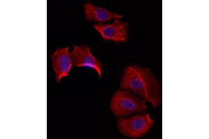 ABIN6258437 and ABIN6274598 staining Hela by IF/ICC. (LI Cadherin 抗体  (Internal Region))