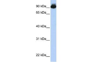 WB Suggested Anti-ELMO3 Antibody Titration:  0. (ELMO3 抗体  (Middle Region))