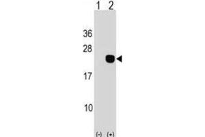 Western Blotting (WB) image for anti-DCMP Deaminase (DCTD) antibody (ABIN2998895) (DCMP Deaminase (DCTD) 抗体)