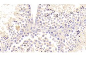 Detection of ACE2 in Mouse Testis Tissue using Polyclonal Antibody to Angiotensin I Converting Enzyme 2 (ACE2) (ACE2 抗体  (AA 93-464))