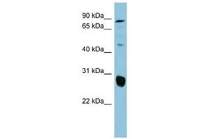 SLC26A4 antibody used at 1 ug/ml to detect target protein. (SLC26A4 抗体  (Middle Region))