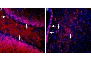Immunohistochemistry (IHC) image for anti-Solute Carrier Family 5 (Sodium/glucose Cotransporter), Member 1 (SLC5A1) (AA 13-25), (Extracellular) antibody (ABIN7043735)
