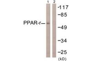 Western blot analysis of extracts from HuvEc cells, using PPAR-gamma (Ab-112) Antibody. (PPARG 抗体  (AA 78-127))