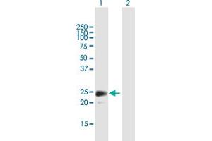 Western Blot analysis of FGF18 expression in transfected 293T cell line by FGF18 MaxPab polyclonal antibody. (FGF18 抗体  (AA 1-207))
