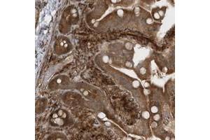 Immunohistochemical staining of human duodenum with AVPI1 polyclonal antibody  shows strong cytoplasmic positivity in glandular cells. (AVPI1 抗体)