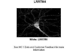 Sample Type :  Rat Hippocampal Neurons - 14DIV  Primary Antibody Dilution :  1:200  Secondary Antibody :  Anti-rabbit-Cy3  Secondary Antibody Dilution :  1:500  Color/Signal Descriptions :  White: LRRTM4  Gene Name :  LRRTM4  Submitted by :  Dan Fowler - University of Oregon, Institute of Neuroscience (LRRTM4 抗体  (Middle Region))