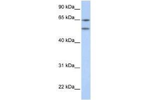WB Suggested Anti-HTR2A Antibody Titration:  0. (HTR2A 抗体  (N-Term))