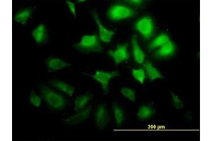 Immunofluorescence of monoclonal antibody to CCNG2 on HeLa cell. (Cyclin G2 抗体  (AA 1-344))