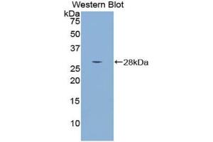 Western blot analysis of the recombinant protein. (SMAD4 抗体  (AA 9-231))