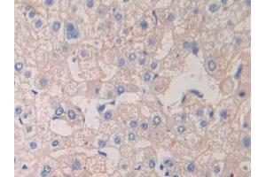DAB staining on IHC-P; Samples: Human Liver Tissue (CrkL 抗体  (AA 1-303))