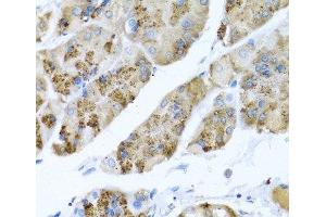 Immunohistochemistry (Paraffin-embedded Sections) (IHC (p)) image for anti-Matrix Gla Protein (MGP) antibody (ABIN7010638)