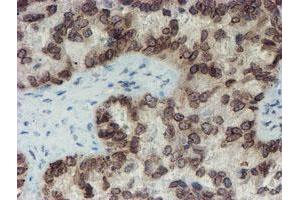 Image no. 4 for anti-SUMO1/sentrin/SMT3 Specific Peptidase 2 (SENP2) (AA 139-523) antibody (ABIN1490926)