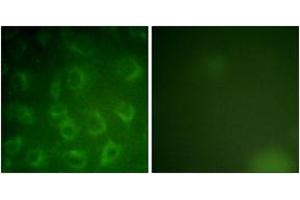 Immunofluorescence analysis of COS7 cells, using PDGFR beta (Ab-1021) Antibody. (PDGFRB 抗体  (AA 991-1040))