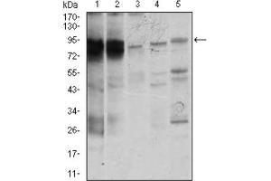 Western blot analysis using STAT5A antibody against K562 (1), MOLT4 (2), HeLa (3), Jurkat (4), and A431 (5) cell lysate. (STAT5A 抗体  (AA 583-794))