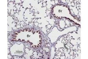 Expression of Adenosine A2A Receptor in rat lungImmunohistochemical staining of paraffin emedded rat lung sections using Anti-Adenosine A2A Receptor Antibody (ABIN7042883, ABIN7043888 and ABIN7043889), (1:50). (Adenosine A2a Receptor (ADORA2A) Peptide)