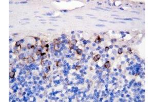 IHC-P: CD40L antibody testing of rat intestine tissue (CD40 Ligand 抗体  (N-Term))
