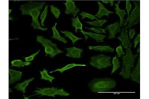 Immunofluorescence (IF) image for anti-Protein Phosphatase 1, Regulatory (Inhibitor) Subunit 1B (PPP1R1B) (AA 1-168) antibody (ABIN529586)