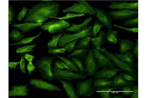 Immunofluorescence (IF) image for anti-Semaphorin 7A, GPI Membrane Anchor (John Milton Hagen Blood Group) (SEMA7A) (AA 536-633) antibody (ABIN521934)