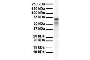WB Suggested Anti-CES2 antibody Titration: 1 ug/mL Sample Type: Human heart (CES2 抗体  (C-Term))