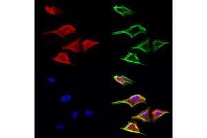 ABIN6265516 and ABIN6272982 staining Hela cells by IF/ICC. (TELO2 抗体  (Internal Region))