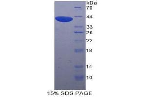 SDS-PAGE analysis of Human UGT8 Protein. (UGT8 蛋白)