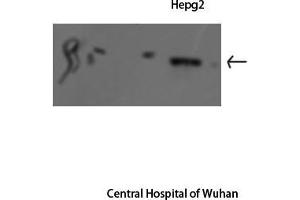 Western Blot (WB) analysis: Please contact us for more details. (STAT1 抗体  (Internal Region))