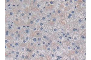 DAB staining on IHC-P; Samples: Human Liver Tissue (HSPB7 抗体  (AA 1-170))