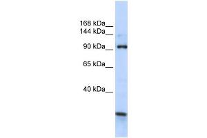 WB Suggested Anti-KIAA1024 Antibody Titration:  0. (KIAA1024 抗体  (C-Term))