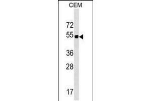 Western blot analysis in CEM cell line lysates (35ug/lane). (ELL3 抗体  (C-Term))