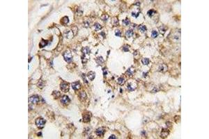 IHC analysis of FFPE human testis tissue stained with PDX1 antibody (PDX1 抗体  (AA 40-69))