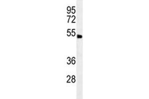 ABHD8 antibody western blot analysis in human NCI-H292 lysate. (ABHD8 抗体  (AA 410-439))