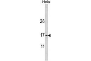 Western blot analysis of MPV17 Antibody (N-term) in Hela cell line lysates (35ug/lane). (MPV17 抗体  (N-Term))