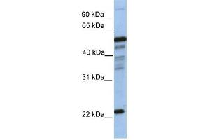 PGDS antibody used at 1 ug/ml to detect target protein. (PTGDS 抗体  (N-Term))