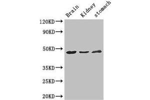 Western Blot Positive WB detected in: Mouse brain tissue, Mouse kidney tissue, Mouse stomach tissue All lanes: AGK antibody at 3 μg/mL Secondary Goat polyclonal to rabbit IgG at 1/50000 dilution Predicted band size: 48, 8 kDa Observed band size: 48 kDa (Acylglycerol Kinase 抗体  (AA 32-65))