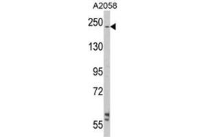 Western blot analysis of LAMB2 Antibody (C-term) in A2058 cell line lysates (35ug/lane). (LAMB2 抗体  (C-Term))