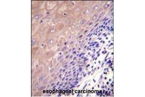 Immunohistochemistry (Paraffin-embedded Sections) (IHC (p)) image for anti-Glutamate-Cysteine Ligase, Catalytic Subunit (GCLC) (AA 1-30), (N-Term) antibody (ABIN655884)