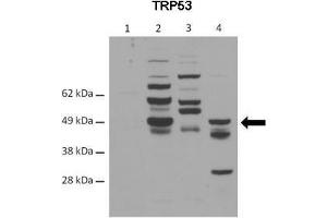 WB Suggested Anti-TRP53 Antibody    Positive Control:  Lane 1: 40ug C57/B6 control mouse G.
