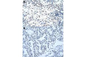 Immunohistochemical staining (Formalin-fixed paraffin-embedded sections) of human kidney (A) and human lung (B) with HNRNPH3 polyclonal antibody  at 4-8 ug/mL working concentration. (HNRNPH3 抗体  (N-Term))